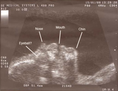 baby2-1-labeled.jpg